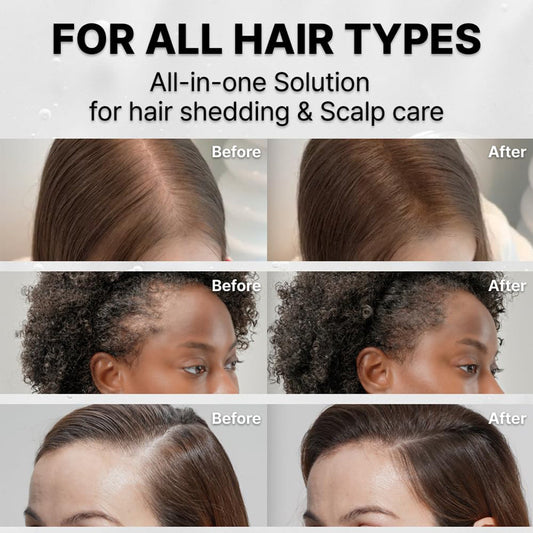 Hair Growth Serum with Built-In Brush Head for Massaging Hair and Improving Scalp